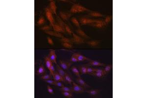 Immunofluorescence analysis of C6 cells using K48-linkage Specific Ubiquitin Rabbit mAb (ABIN1680189, ABIN3017871, ABIN3017872 and ABIN7101530) at dilution of 1:100 (40x lens). (Ubiquitin B antibody)