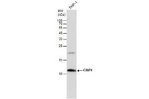 CRIP1 antibody detects CRIP1 protein by western blot analysis. (CRIP1 antibody  (C-Term))