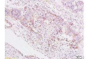 Immunohistochemistry (Paraffin-embedded Sections) (IHC (p)) image for anti-V-Set Domain Containing T Cell Activation Inhibitor 1 (VTCN1) (AA 50-100) antibody (ABIN671736)