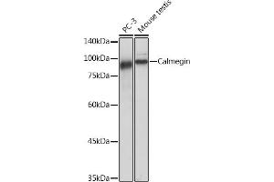 Western blot analysis of extracts of various cell lines, using Calmegin Rabbit mAb (ABIN7266025) at 1:1000 dilution. (Calmegin antibody)