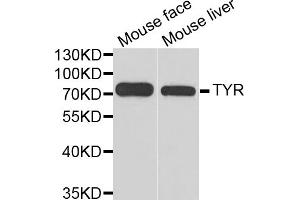 Western blot analysis of extracts of various cell lines, using TYR antibody. (TYR antibody)