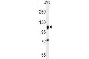 Western Blotting (WB) image for anti-Mannosidase, Alpha, Class 2A, Member 1 (MAN2A1) antibody (ABIN2995944) (alpha-Mannosidase II antibody)