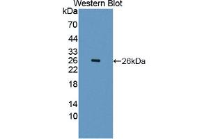 Figure. (Growth Hormone 2 antibody  (AA 27-217))