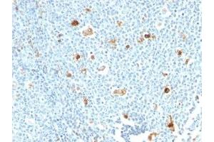 Formalin-fixed, paraffin-embedded human tonsil stained with Calprotectin antibody (CPT/1028) (Calprotectin antibody)