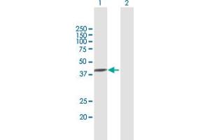 Western Blot analysis of TXNDC5 expression in transfected 293T cell line by TXNDC5 MaxPab polyclonal antibody. (TXNDC5 antibody  (AA 1-360))