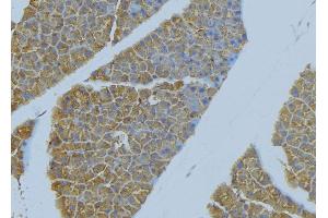 ABIN6277655 at 1/100 staining Human pancreas tissue by IHC-P. (ICAM1 antibody  (C-Term))