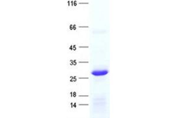 RPL10L Protein (His tag)