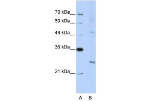 EXOSC4 antibody used at 5 ug/ml to detect target protein. (EXOSC4 antibody  (N-Term))