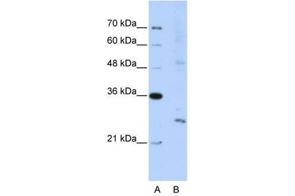 EXOSC4 antibody  (N-Term)