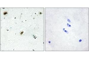 Immunohistochemistry (IHC) image for anti-C-Abl Oncogene 1, Non-Receptor tyrosine Kinase (ABL1) (AA 861-910) antibody (ABIN2889373) (ABL1 antibody  (AA 861-910))