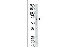 Antibody is used in Western blot to detect PAPSS2 in Jurkat cell lysate. (PAPSS2 antibody  (C-Term))