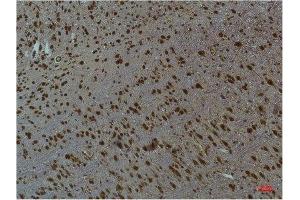 Immunohistochemistry (IHC) analysis of paraffin-embedded Mouse Brain Tissue using CaMKIIbeta/ gamma /delta (Phospho Thr287) Mouse Monoclonal Antibody diluted at 1:200. (CaMKIIbeta/gamma/delta antibody  (pThr287))