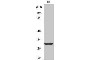 Western Blotting (WB) image for anti-ATP-Binding Cassette, Sub-Family C (CFTR/MRP), Member 13, Pseudogene (ABCC13) (Internal Region) antibody (ABIN3183116) (ABCC13 antibody  (Internal Region))