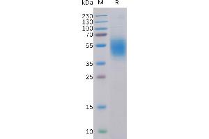 Human CA Protein, His Tag on SDS-PAGE under reducing condition. (CLEC12A Protein (AA 65-265) (His tag))