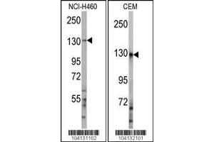 Western blot analysis of anti-UBE4A Antibody in NCI-H460 and CEM cell line lysates (35ug/lane) (UBE4A antibody  (C-Term))