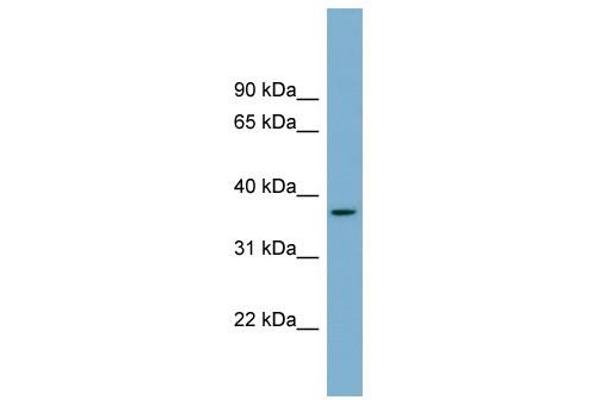 OR2W5 抗体  (Middle Region)