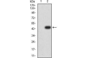 Western blot analysis using ADAR mAb against HEK293 (1) and ADAR (AA: 1085-1223)-hIgGFc transfected HEK293 (2) cell lysate. (ADAR antibody  (AA 1085-1223))