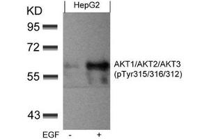 Western blot analysis of extracts from HepG2 cells untreated or treated with EGF using AKT1/AKT2/AKT3(phospho-Tyr315/316/312) Antibody. (AKT 1/2/3 antibody  (pTyr312, pTyr315, pTyr316))
