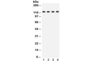 Western blot testing of human 1) HeLa, 2) Jurkat, 3) SKOV and 4) mouse kidney lysate with SLC12A1 antibody. (SLC12A1 antibody)