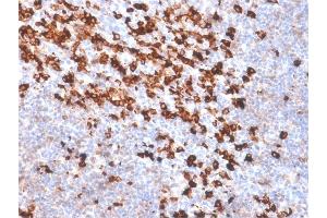 Formalin-fixed, paraffin-embedded Tonsil stained with biotinylated Kappa Light Chain probe followed by anti-biotin Rabbit Recombinant Monoclonal antibody (BTN/2032R). (Recombinant Biotin antibody)