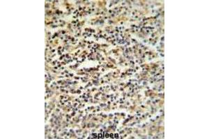 Immunohistochemistry (IHC) image for anti-Coiled-Coil Domain Containing 101 (CCDC101) antibody (ABIN3002249) (SGF29 antibody)