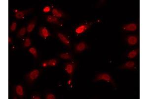 Immunofluorescence analysis of U2OS cells using HNRNPF antibody. (HNRNPF antibody  (AA 1-280))