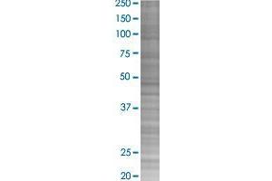 NETO2 transfected lysate. (NETO2 293T Cell Transient Overexpression Lysate(Denatured))