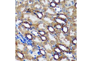 Immunohistochemistry of paraffin-embedded Mouse kidney using TMX2 Rabbit pAb (ABIN7270810) at dilution of 1:100 (40x lens). (TMX2 antibody  (AA 128-296))