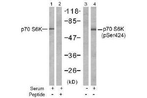 Image no. 1 for anti-Ribosomal Protein S6 Kinase, 70kDa, Polypeptide 1 (RPS6KB1) (pSer424) antibody (ABIN197052) (RPS6KB1 antibody  (pSer424))