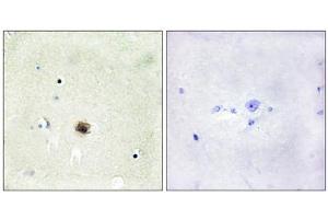 Immunohistochemistry analysis of paraffin-embedded human brain tissue using CSRP1 antibody. (CSRP1 antibody  (Internal Region))