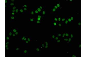 Immunofluorescence staining of HepG2 cells with ABIN7139608 at 1:2. (Histone H1-Like (LOC107807853) (meLys81) antibody)