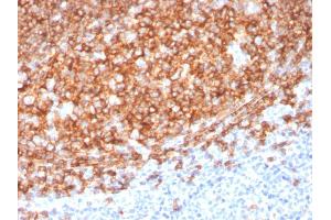 Formalin-fixed, paraffin-embedded human Tonsil stained with CD20 Mouse Monoclonal Antibody (MS4A1/3410). (CD20 antibody  (AA 213-297))