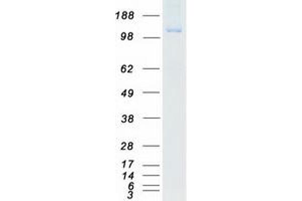 TRIM33 Protein (Transcript Variant A) (Myc-DYKDDDDK Tag)