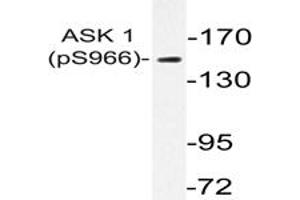 Image no. 1 for anti-Mitogen-Activated Protein Kinase Kinase Kinase 5 (MAP3K5) (pSer966) antibody (ABIN317962) (ASK1 antibody  (pSer966))