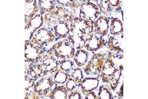 Immunohistochemistry of paraffin-embedded mouse kidney using NOX/p67phox Rabbit mAb (ABIN1679067, ABIN7101556, ABIN7101557 and ABIN7101558) at dilution of 1:100 (40x lens). (NCF2 antibody)
