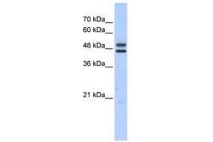 Image no. 1 for anti-Excision Repair Cross-Complementing Rodent Repair Deficiency, Complementation Group 8 (ERCC8) (C-Term) antibody (ABIN6741466) (ERCC8 antibody  (C-Term))