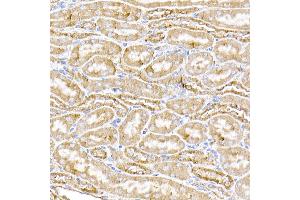 Immunohistochemistry of paraffin-embedded human liver using STING/TMEM173 Rabbit pAb (ABIN1683049, ABIN3017833, ABIN3017834 and ABIN6220283) at dilution of 1:50 (40x lens). (STING/TMEM173 antibody  (AA 170-379))