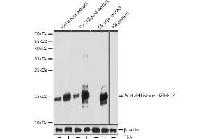 Western blot analysis of extracts of various cell lines, using Acetyl-Histone H2B-K12 antibody (ABIN7267731) at 1:1000 dilution. (Histone H2B antibody  (acLys12))