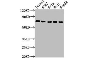 Recombinant FUBP1 antibody