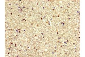 IHC image of ABIN7155497 diluted at 1:500 and staining in paraffin-embedded human brain tissue performed on a Leica BondTM system. (MECOM antibody  (AA 534-632))