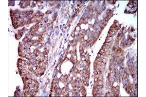 Immunohistochemistry (IHC) image for anti-Signal Transducer and Activator of Transcription 5A (STAT5A) (AA 583-794) antibody (ABIN1098129)