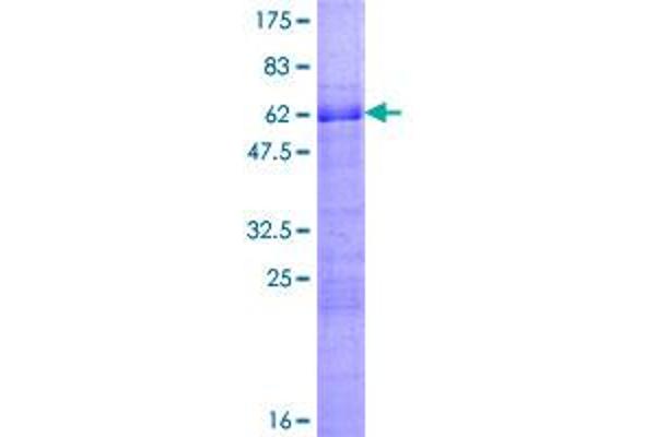 WT1 Protein (AA 1-302) (GST tag)