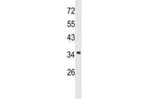 Western blot analysis of Annexin A1 antibody and A2058 lysate. (Annexin a1 antibody  (AA 129-158))