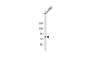 Anti-ZNF12 Antibody (N-term) at 1:1000 dilution + NCI- whole cell lysate Lysates/proteins at 20 μg per lane. (ZNF12 antibody  (N-Term))