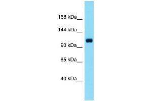Host: Rabbit  Target Name: Scube1  Sample Tissue: Mouse Liver lysates  Antibody Dilution: 1. (SCUBE1 antibody  (C-Term))