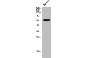 Western Blot analysis of Jurkat cells using PFK-2 liv Polyclonal Antibody (PFKFB1 antibody  (C-Term))