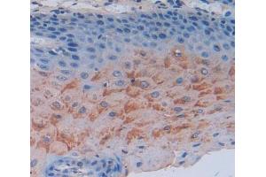 Used in DAB staining on fromalin fixed paraffin- embedded esophagus tissue (SCEL antibody  (AA 519-685))