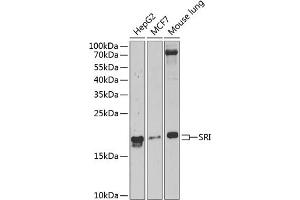 Western blot analysis of extracts of various cell lines, using SRI Antibody  at 1:1000 dilution. (SRI antibody  (AA 1-198))