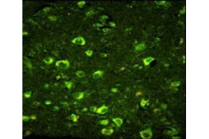 Immunofluorescence analysis of ABI1 antibody with paraffin-embedded human brain tissue. (ABI1 antibody  (AA 81-108))