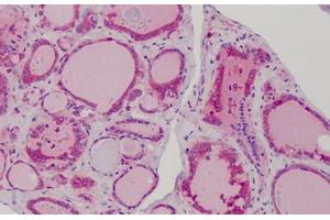 人类甲状腺：福尔马林固定，石蜡包埋（FFPE）（MAD2L1抗体（AA 1-174））